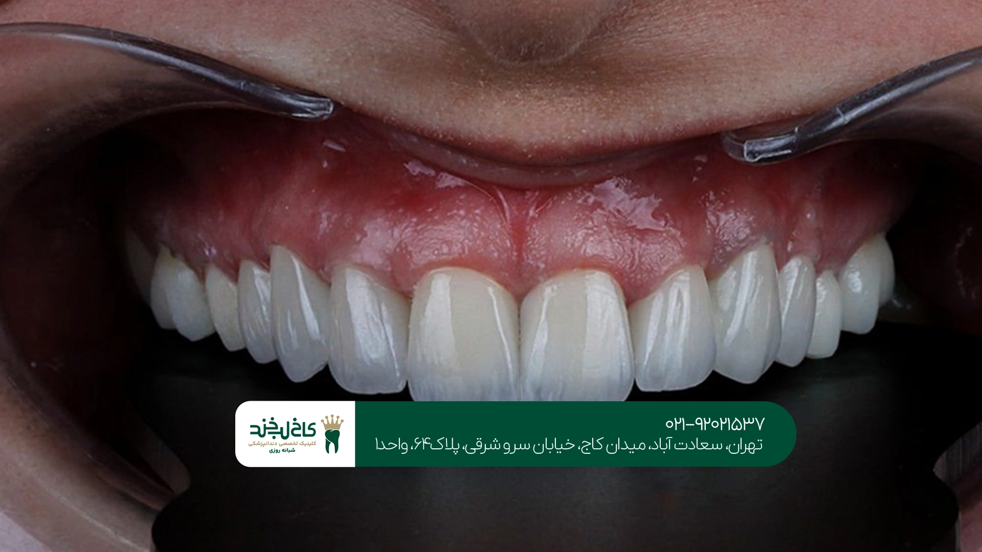 ویژگی های دندانپزشکی زیبایی