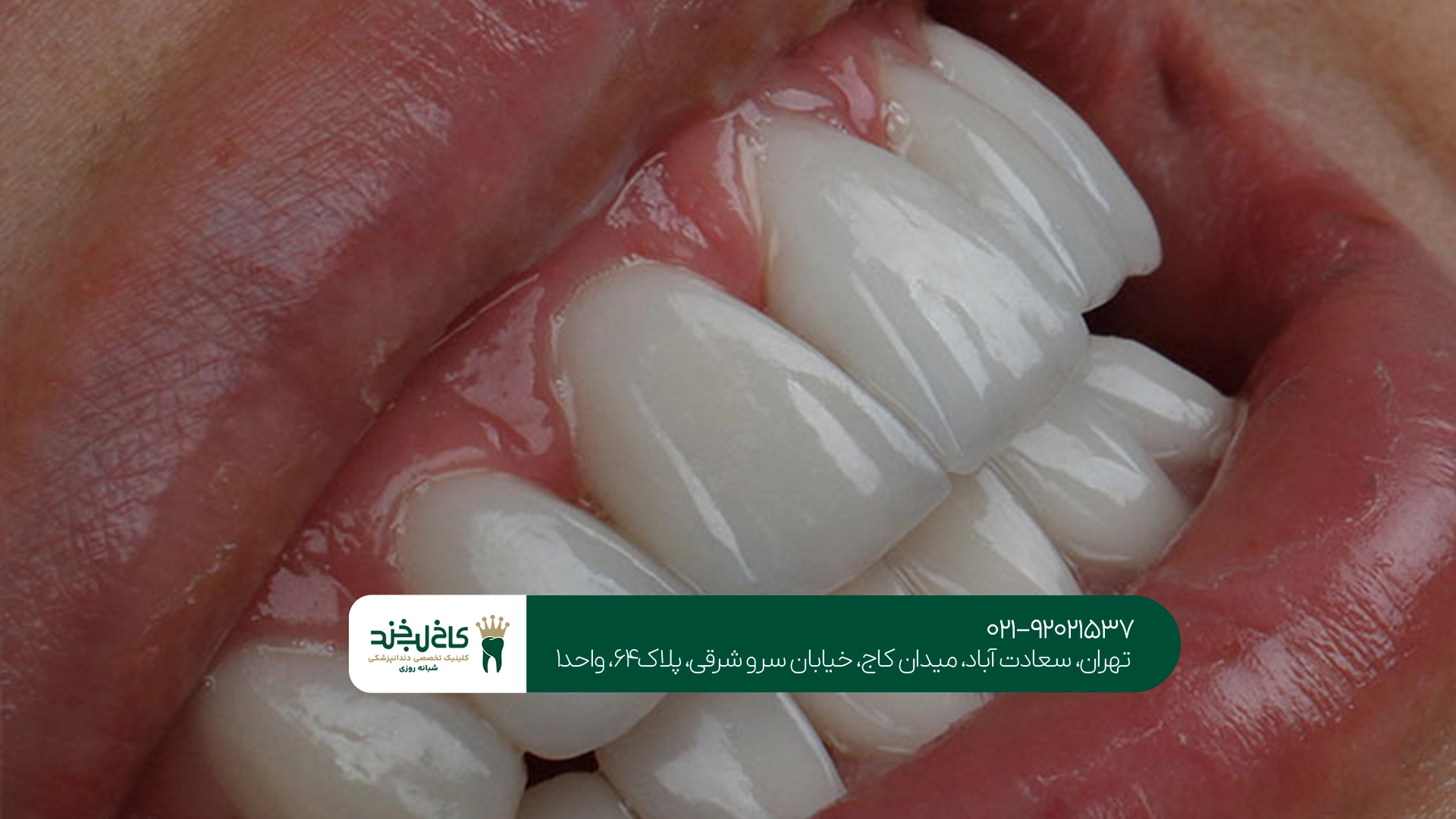 دندانپزشکی زیبایی