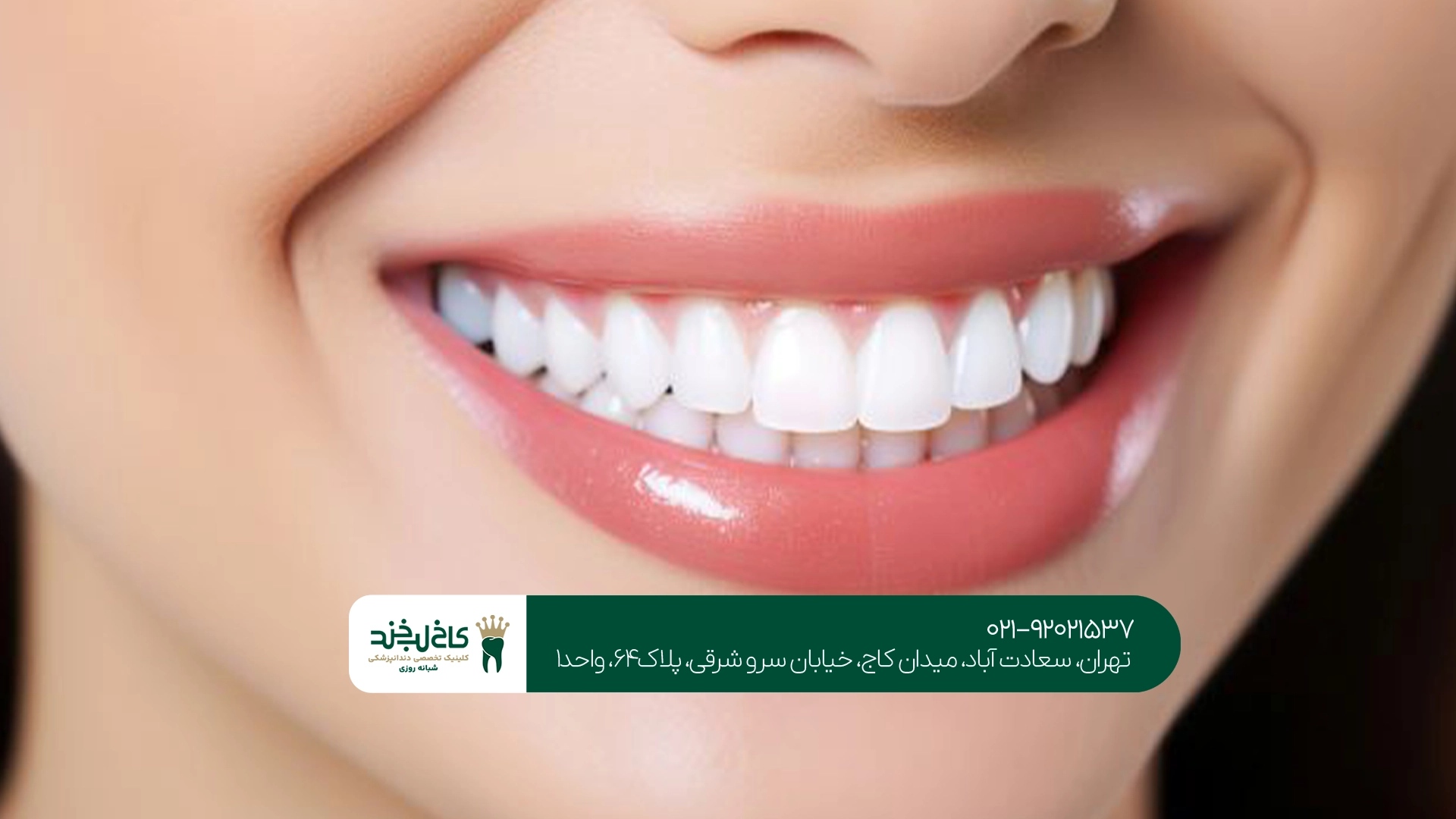 دندانپزشکی زیبایی در تهران