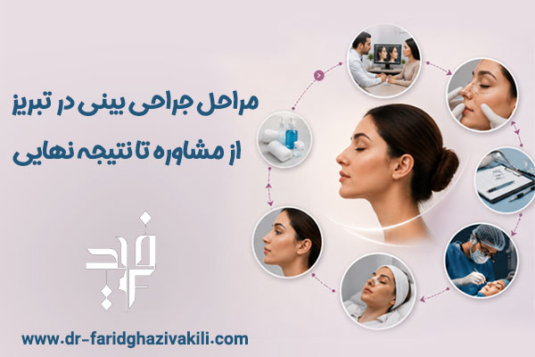 جراحی بینی در تبریز یا دکتر فرید قاضی وکیلی